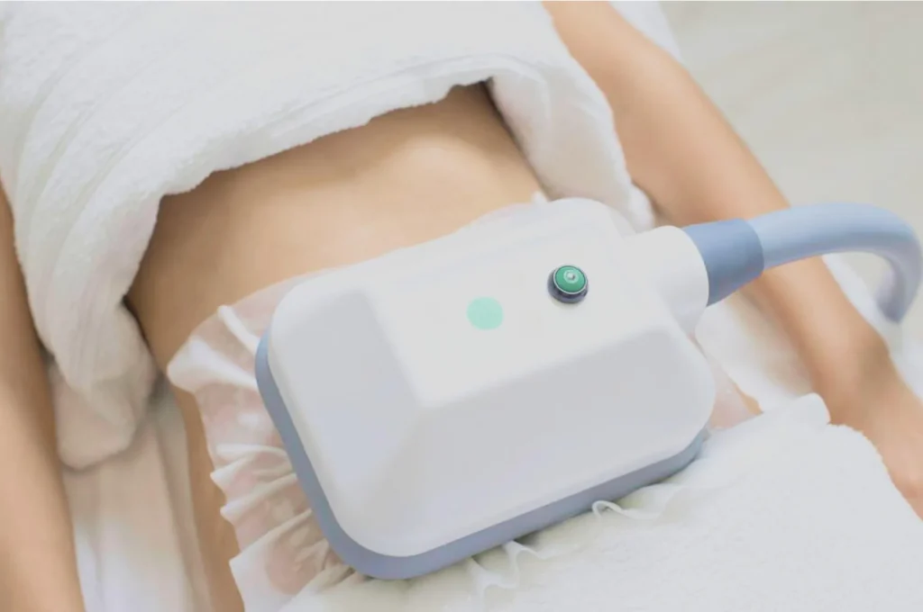 How Fat Freezing and HIFU Work Together? 3 advantages to combining Fat Freezing and HIFU Rotherham