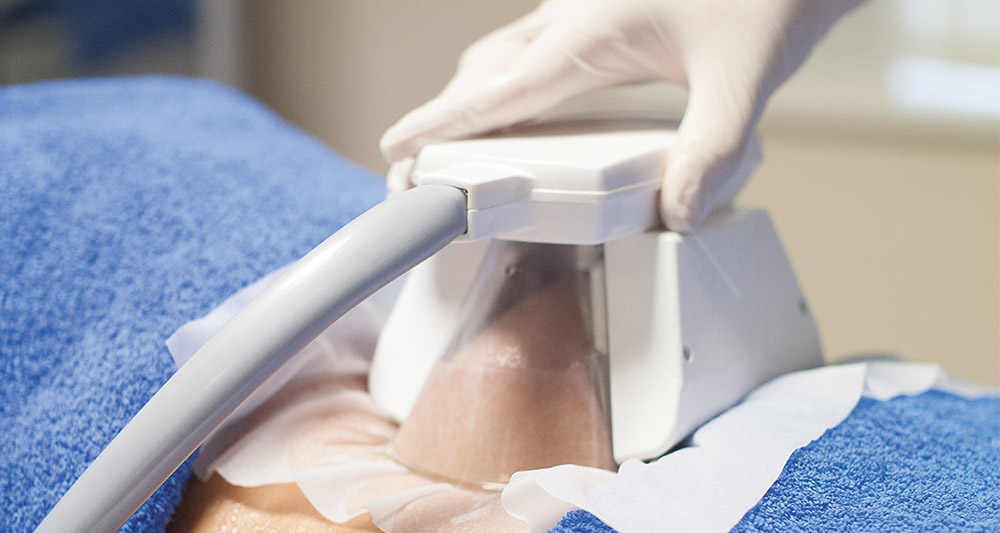 How Fat Freezing and HIFU Work Together? 2 Multiple Areas in One Session HIFU and Fat Freezing Rotherham