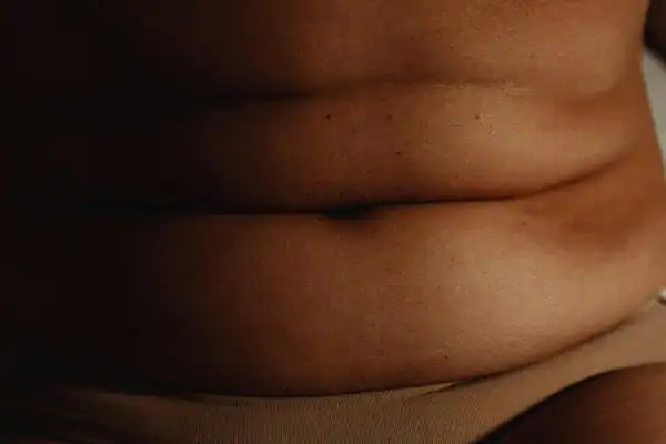 The Hidden Connection: How Stress Shapes Your Fitness and Body Composition 3 image of what stress can do on the stomach area and how Lipo 360 Rotherham can help to change your body shape.